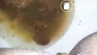 runny shit between legs 2