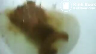 runny shit between legs 2