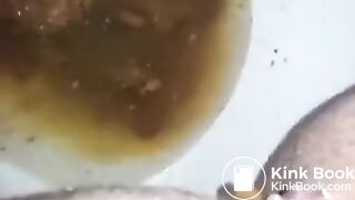 runny shit between legs 2