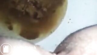runny shit between legs 2