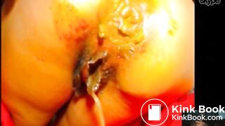 Meaty pussy and asshole