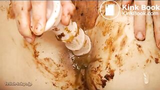 Dirty anal prolapse and masturbation