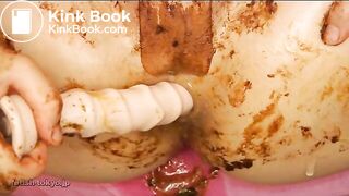 Dirty anal prolapse and masturbation