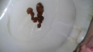 amateur 2 poop 8