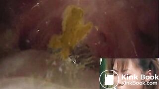 Exodus Gold 09 - DWS-09