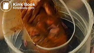 Scat nurses male patient huge load