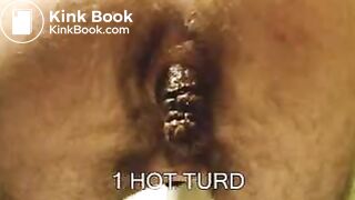Hairy Guy Pushes Out a MASSIVE Turd