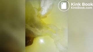 Close Up Shy Poop