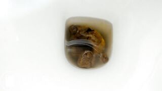 Fat Ass Suppository Shit