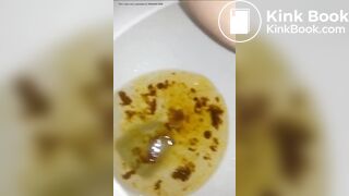 Close-Up Diarrhea