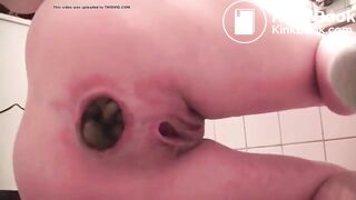 Straining Out A Hard Poop