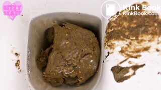 Painful constipation huge log