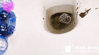 Painful constipation huge log