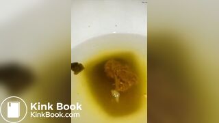 Closeup Soft Turds & Creamy Discharge