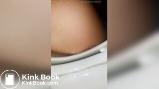 Closeup Soft Turds & Creamy Discharge