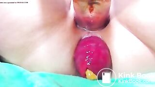 prolapse 2 poo