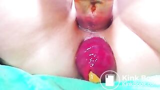 prolapse 2 poo