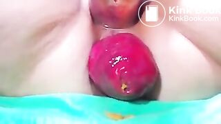 prolapse 2 poo