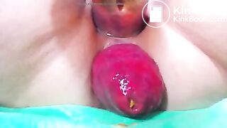 prolapse 2 poo