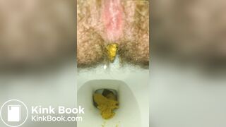 Massive Dump From Hairy Trans Ass