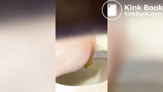 Prolapse toilet - video 2