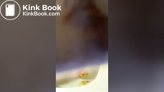Prolapse toilet - video 2