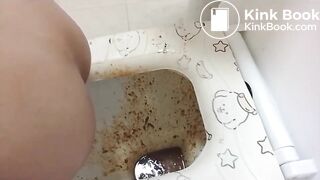 Severe diarrhea - video 6