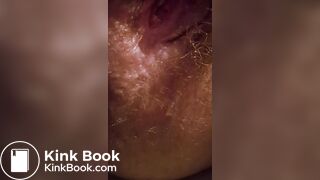 My ass is constipated today (I think)