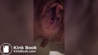 Asshole empty poo