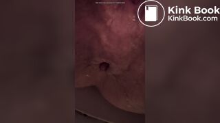 Asshole empty poo