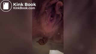 Asshole empty poo