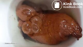 Constipation - video 8