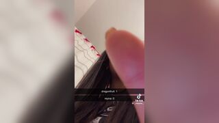 Girl gets diarrhea from eating Dragon Fruit