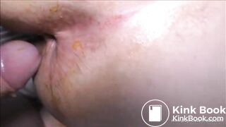 Freaky dirty anal sex 4