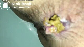 Cacca - video 8