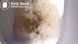 Girl pooping - video 844