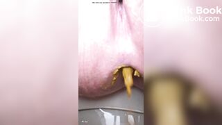 Soft diarrhea close up girl