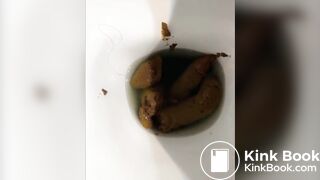 Daily Pressure From Pretty Assholes