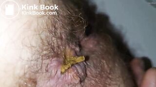 Shit in more detail