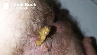 Shit in more detail