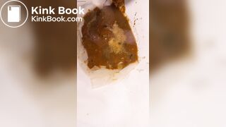 Chinese girl have watery diarrhea1