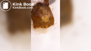 Chinese girl have watery diarrhea1