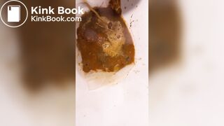Chinese girl have watery diarrhea1