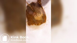 Chinese girl have watery diarrhea1