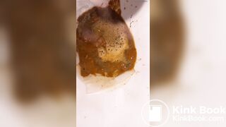 Chinese girl have watery diarrhea1