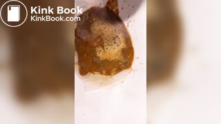 Chinese girl have watery diarrhea1