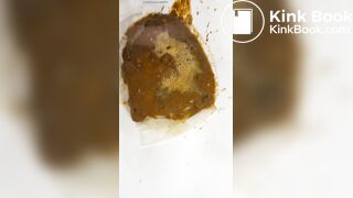 Chinese girl have watery diarrhea1