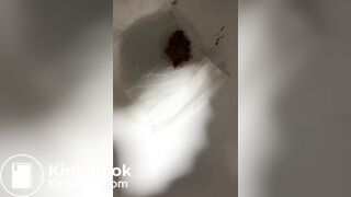 Chinese girl have watery diarrhea1