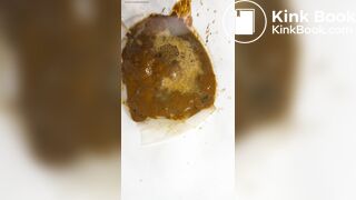 Chinese girl have watery diarrhea1