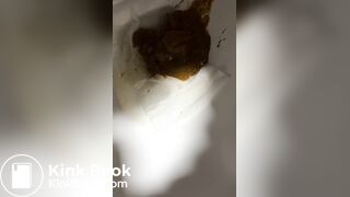 Chinese girl have watery diarrhea1